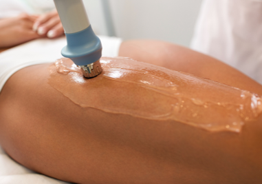 5 facts about shockwave therapy